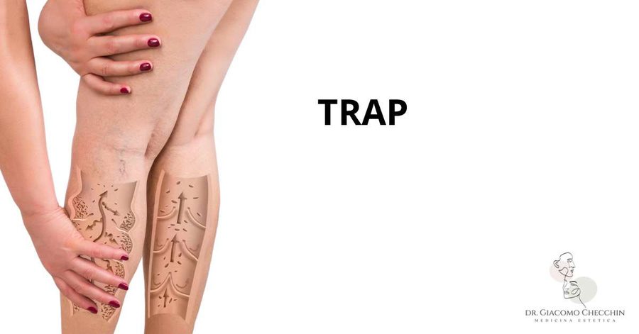 Fleboterapia Rigenerativa Tridimensionale Ambulatoriale (TRAP)