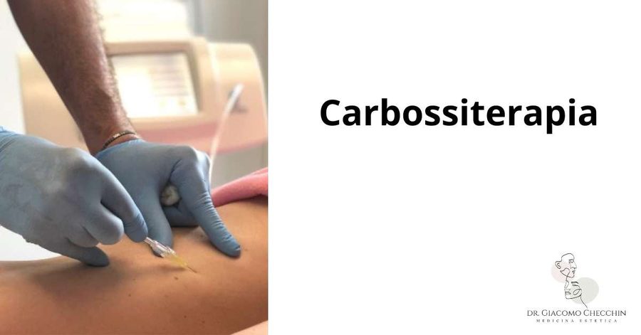 Carbossiterapia per la cellulite