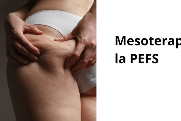 Mesoterapia per la cellulite