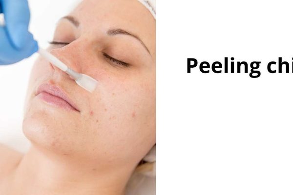Peeling chimici