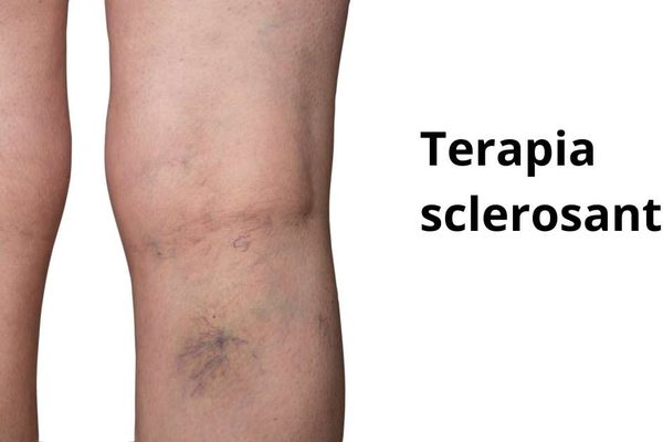 Terapia sclerosante