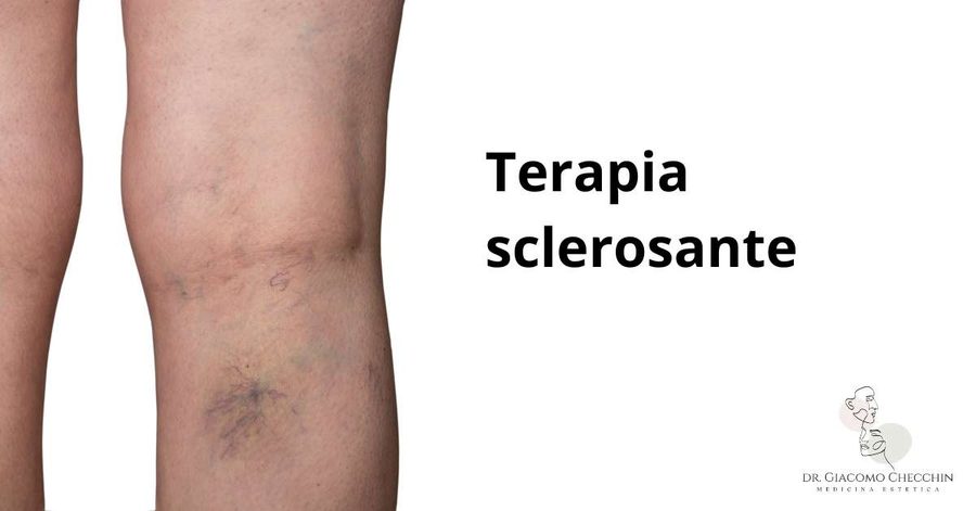 Terapia sclerosante