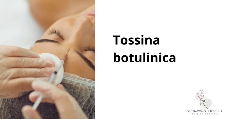 Tossina botulinica