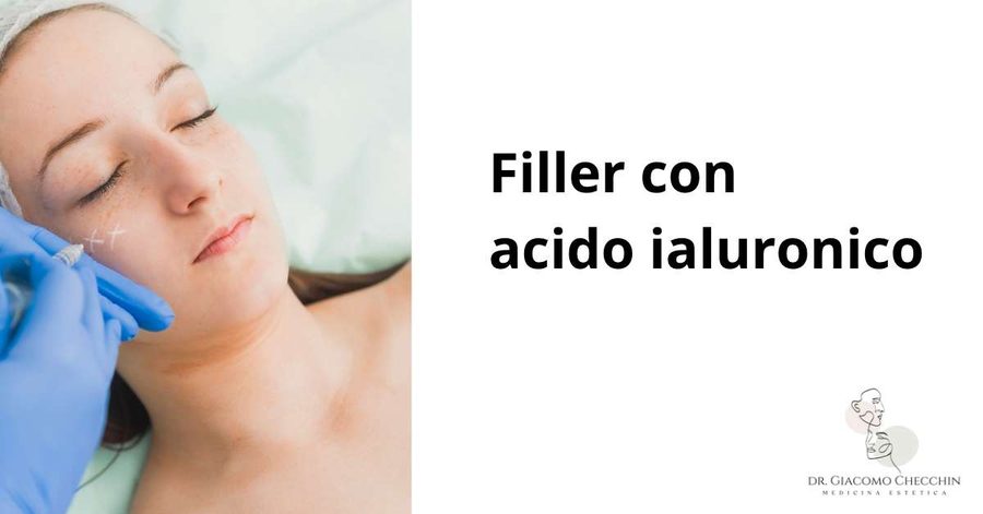 Filler con acido ialuronico