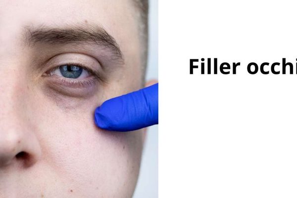 Filler occhiaie