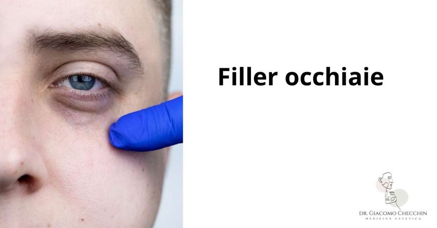 Filler occhiaie