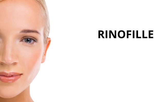 Rinofiller