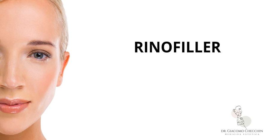 Rinofiller